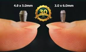 Implantologia 4 short implants bicon
